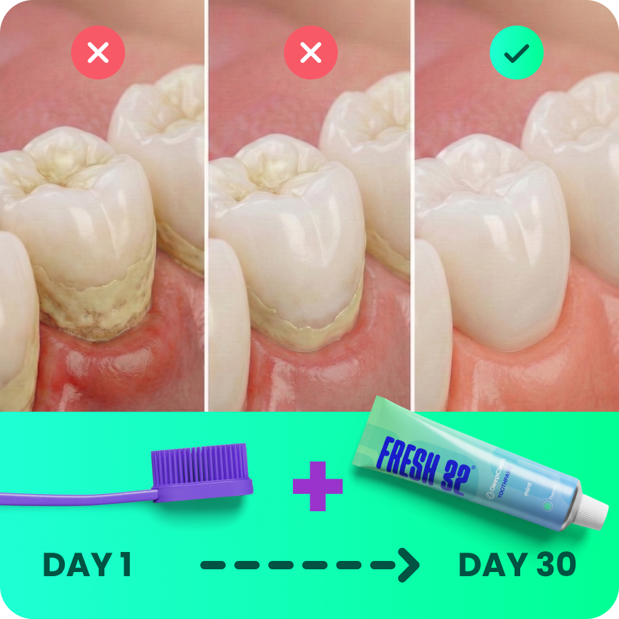 What actually helps reduce tartar long term?